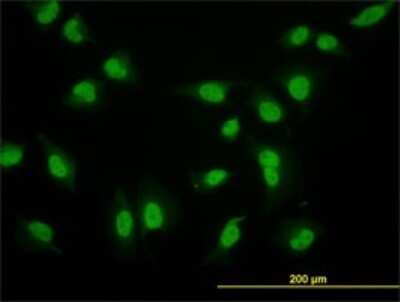 Immunocytochemistry/ Immunofluorescence: MED17 Antibody (1B5) [H00009440-M02]