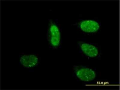 Immunocytochemistry/ Immunofluorescence: MED17 Antibody (4D4) [H00009440-M01]