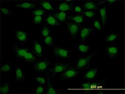 Immunocytochemistry/ Immunofluorescence: MED21 Antibody (2D9) [H00009412-M10]