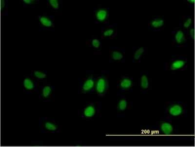 Immunocytochemistry/ Immunofluorescence: MED21 Antibody (3E9) [H00009412-M08]