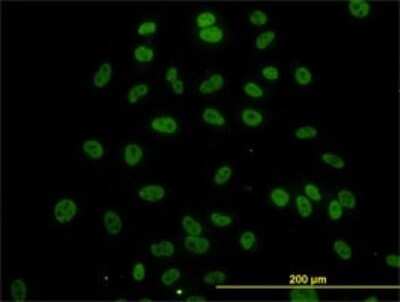 Immunocytochemistry/ Immunofluorescence: MED21 Antibody (5A6) [H00009412-M04]