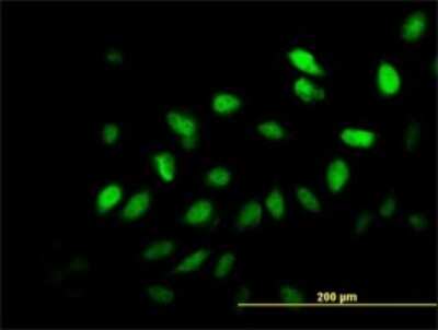 Immunocytochemistry/ Immunofluorescence: MED21 Antibody (6B6) [H00009412-M03]
