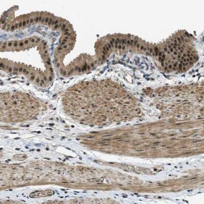 Immunohistochemistry-Paraffin: MED21 Antibody [NBP1-87006]