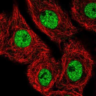 Immunocytochemistry/ Immunofluorescence: MED25 Antibody [NBP2-55868]