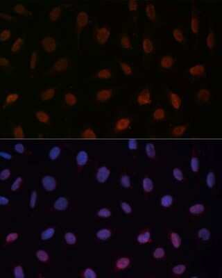 Immunocytochemistry/ Immunofluorescence: MED25 Antibody - Azide and BSA Free [NBP3-04944]