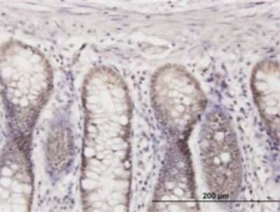 Immunohistochemistry-Paraffin: MED27 Antibody (8B8) [H00009442-M01]
