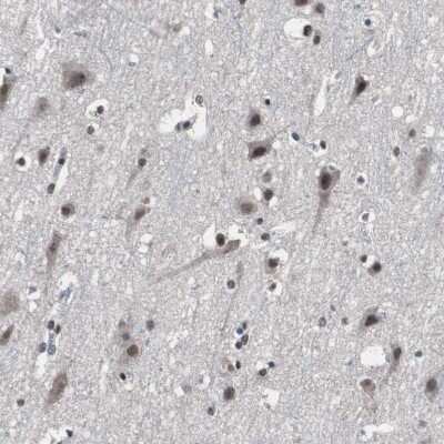 Immunohistochemistry-Paraffin: MED27 Antibody [NBP1-84377]