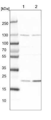 Western Blot: MED28 Antibody [NBP1-85104]