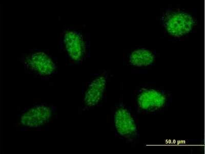 Immunocytochemistry/ Immunofluorescence: MED29 Antibody [H00055588-B01P]