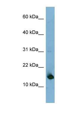 Western Blot: MED31 Antibody [NBP1-56861]