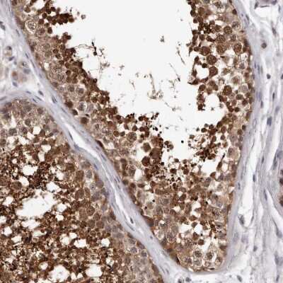 Immunohistochemistry-Paraffin: MED8 Antibody [NBP1-89014]