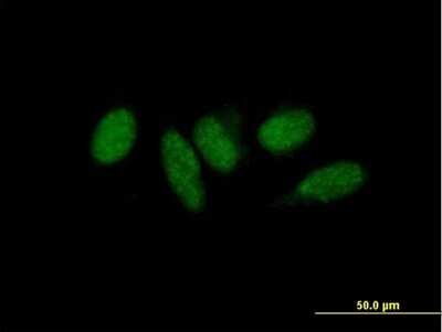 Immunocytochemistry/ Immunofluorescence: MED9 Antibody [H00055090-B01P]