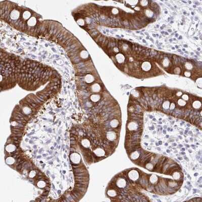 Immunohistochemistry: MED9 Antibody [NBP2-31639]