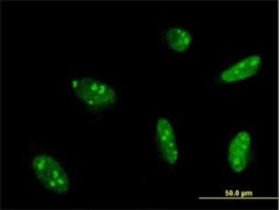 Immunocytochemistry/ Immunofluorescence: MEF2A Antibody (1A10) [H00004205-M02]