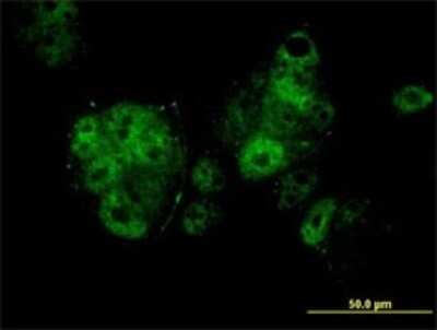 Immunocytochemistry/ Immunofluorescence: MEF2A Antibody (1C8) [H00004205-M15]
