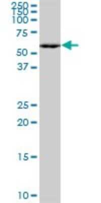 Western Blot: MEF2A Antibody (1C8) [H00004205-M15]