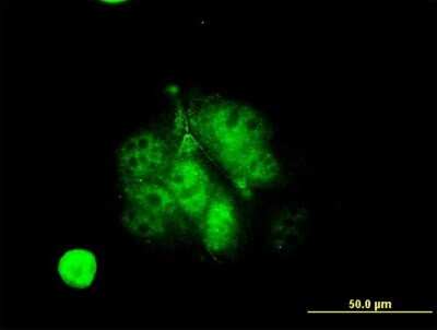 Immunocytochemistry/ Immunofluorescence: MEF2A Antibody (1F8) [H00004205-M08]