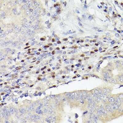 Immunohistochemistry-Paraffin: MEF2A/C Antibody (10I9G9) [NBP3-16143]