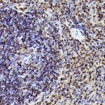 Immunohistochemistry-Paraffin: MEF2A/C Antibody (10I9G9) [NBP3-16143]