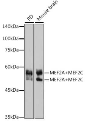 Western Blot: MEF2A/C Antibody (10I9G9) [NBP3-16143]