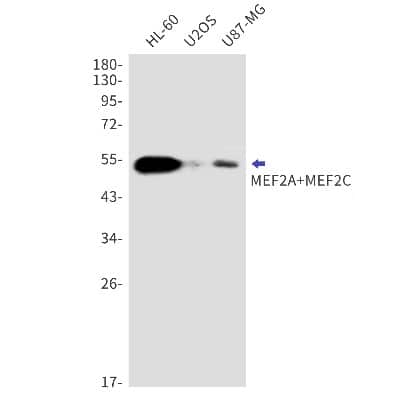 Western Blot: MEF2A/C Antibody (S04-8B2) [NBP3-14870]