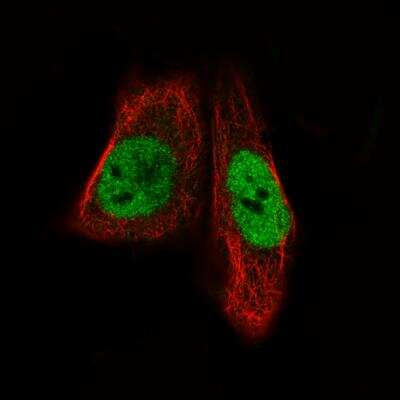 Immunocytochemistry/ Immunofluorescence: MEF2C Antibody (CL0368) [NBP2-52925]