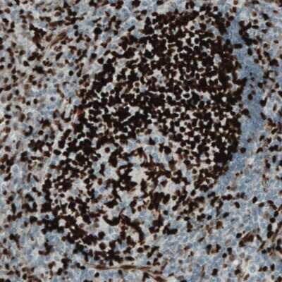 Immunohistochemistry-Paraffin: MEF2C Antibody (CL0368) [NBP2-52925]