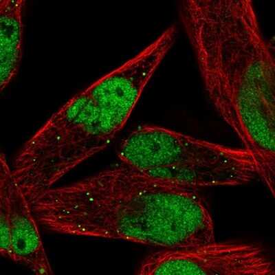 Immunocytochemistry/ Immunofluorescence: MEF2C Antibody [NBP1-89468]
