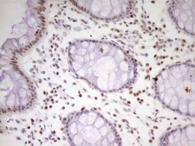 Immunohistochemistry: MEF2D Antibody (OTI1E11) [NBP2-45812]
