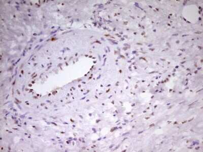 Immunohistochemistry: MEF2D Antibody (OTI1E11) [NBP2-45812]