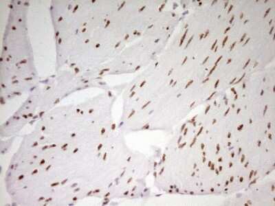 Immunohistochemistry: MEF2D Antibody (OTI1E11) [NBP2-45812]