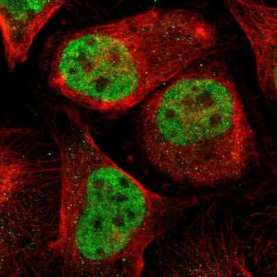 Immunocytochemistry/ Immunofluorescence: MEF2D Antibody [NBP1-85788]