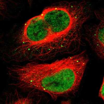 Immunocytochemistry/ Immunofluorescence: MEF2D Antibody [NBP1-85795]