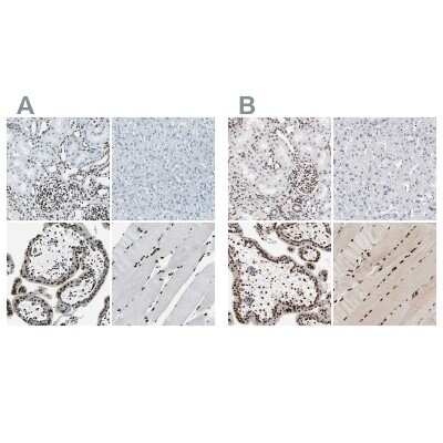Immunohistochemistry-Paraffin: MEF2D Antibody [NBP1-85788]