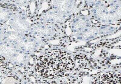 Immunohistochemistry-Paraffin: MEF2D Antibody [NBP1-85788]