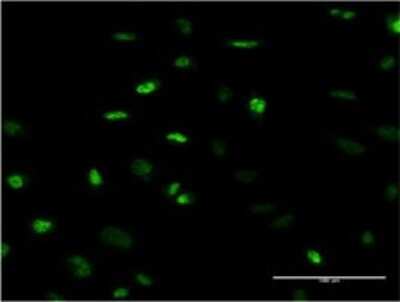 Immunocytochemistry/ Immunofluorescence: MEFV Antibody (2C1) [H00004210-M02]