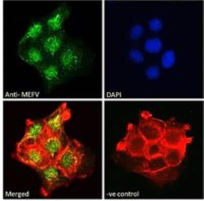 Immunocytochemistry/ Immunofluorescence: MEFV Antibody [NB600-809]