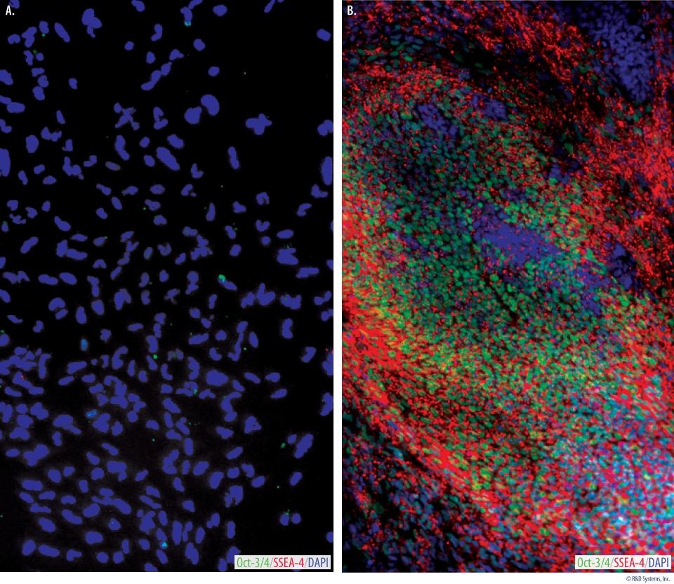 Human Emryonic Fibroblast Conditioned Media Express Pluripotent Markers SSEA-4 and Oct-3/4.