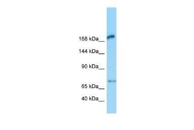 Western Blot: MEGF6 Antibody [NBP2-83190]