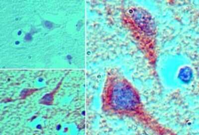 Immunohistochemistry-Paraffin: MEIS1 Antibody [NBP2-24597]