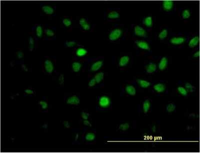 Immunocytochemistry/ Immunofluorescence: MEIS2 Antibody (1D1) [H00004212-M03]