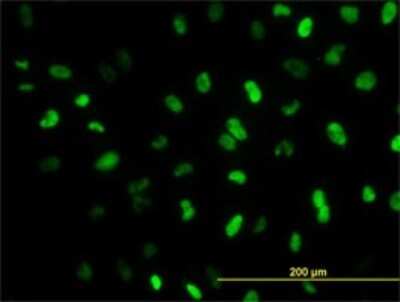 Immunocytochemistry/ Immunofluorescence: MEIS2 Antibody (1H4) [H00004212-M01]