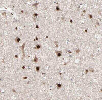 Immunohistochemistry-Paraffin: MEIS2 Antibody [NBP1-81669]