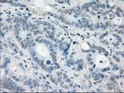 Immunohistochemistry-Paraffin: MEK1 Antibody (OTI1F5) [NBP1-47833]