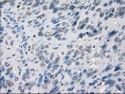 Immunohistochemistry-Paraffin: MEK1 Antibody (OTI1F5) [NBP1-47833]