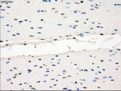 Immunohistochemistry-Paraffin: MEK1 Antibody (OTI1F5) [NBP1-47833]