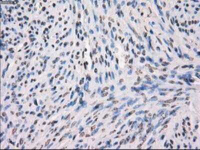 Immunohistochemistry-Paraffin: MEK1 Antibody (OTI1F5) [NBP1-47833]