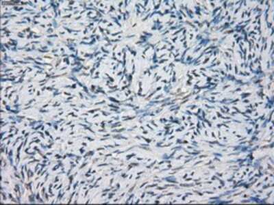 Immunohistochemistry-Paraffin: MEK1 Antibody (OTI1F5) [NBP1-47833]