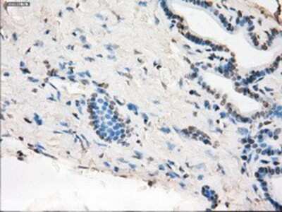 Immunohistochemistry-Paraffin: MEK1 Antibody (OTI1F5) [NBP1-47833]