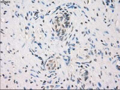 Immunohistochemistry-Paraffin: MEK1 Antibody (OTI1F5) [NBP1-47833]